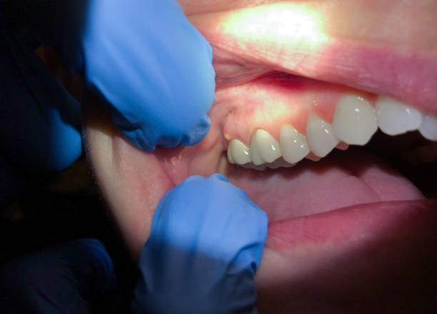 Best Emergency Dental Services for Seniors in West Elmira, NY